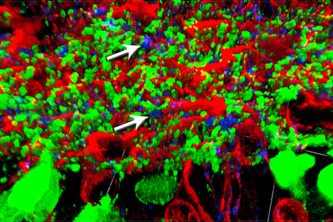 Seiler lab image of retinal cells